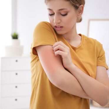 Skin-diseases-370x370 Skin-diseases-370x370